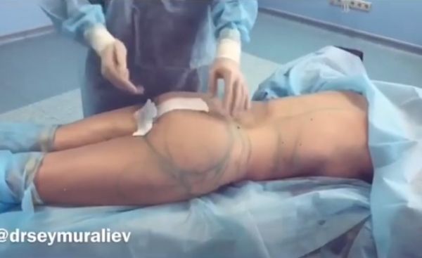 Певица Асти выложила откровенное видео, сделанное во время операции по изменению фигуры