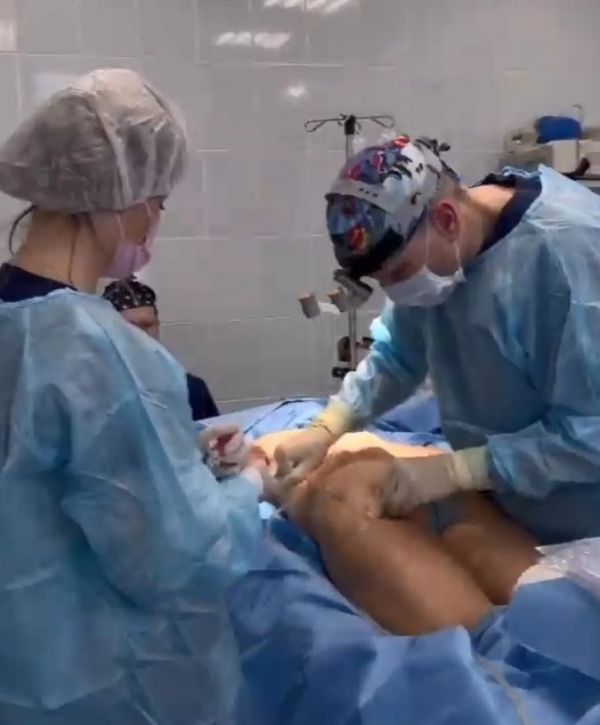Дана Борисова показала селфи груди с жуткими гематомами после операции