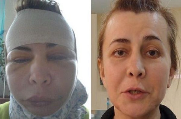 Ирига Агибалова из Дома-2 показала, как правильно массажировать лицо (видео) Ирига Агибалова из Дома-2 показала, как правильно массажировать лицо (видео)