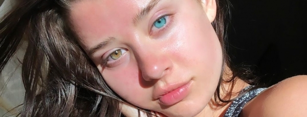 Сара Макдэниел, девушка с разным цветом глаз, обнажилась на фоне природы
